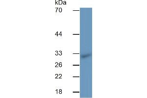 Detection antibody from the kit in WB with Positive Control:  Sample Rat Spleen lysate.