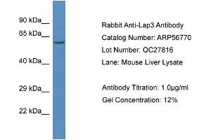 Western Blotting (WB) image for anti-Cytosol Aminopeptidase (LAP3) (N-Term) antibody (ABIN2786892) (LAP3 抗体  (N-Term))