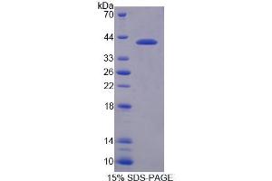 SDS-PAGE analysis of Human NCOR1 Protein. (NCOR1 蛋白)