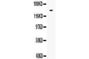 Anti- FLT1 antibody, Western blottingAll lanes: Anti VEGF Receptor 1  at 0. (FLT1 抗体  (N-Term))
