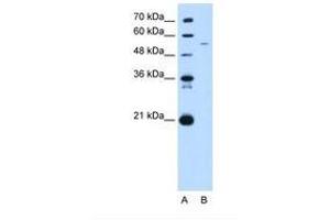 Image no. 1 for anti-Growth Arrest-Specific 7 (GAS7) (C-Term) antibody (ABIN321339) (GAS7 抗体  (C-Term))