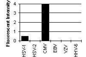 Cross Reactivity Results determined by IFA (Pp28 Tegument Protein (CMV Pp28) 抗体)