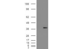 Western Blotting (WB) image for anti-Aldo-Keto Reductase Family 1, Member B1 (Aldose Reductase) (AKR1B1) antibody (ABIN5912019) (AKR1B1 抗体)