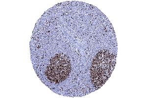 In lymph nodes a particularly strong MCM7 staining occurs in most cells of germinal centres (Recombinant MCM7 抗体  (AA 195-319))