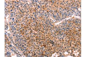 Immunohistochemistry (IHC) image for anti-Cytochrome P450, Family 1, Subfamily B, Polypeptide 1 (CYP1B1) antibody (ABIN7129127)