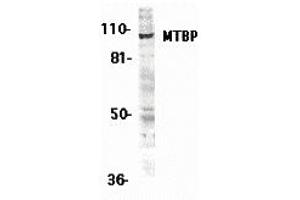 Western Blotting (WB) image for anti-MDM2 Binding Protein (MTBP) (Middle Region 2) antibody (ABIN1031200) (MTBP 抗体  (Middle Region 2))