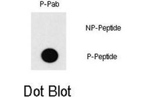 Dot blot analysis of MEF2C (phospho T20) polyclonal antibody  on nitrocellulose membrane. (MEF2C 抗体  (pThr20))