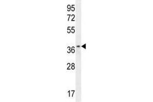 ZNF322B antibody western blot analysis in HL-60 lysate (ZNF322P1 抗体  (AA 326-354))