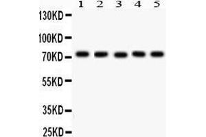 Western Blotting (WB) image for anti-Embryonic Ectoderm Development (EED) (AA 256-441) antibody (ABIN3043370) (EED 抗体  (AA 256-441))