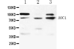 Western blot analysis of ABP1 expression in NRK whole cell lysates ( Lane 1), 293T whole cell lysates ( Lane 2) and MCF-7 whole cell lysates ( Lane 3). (DAO 抗体  (N-Term))
