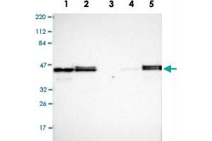 Western Blot analysis of Lane 1: RT-4, Lane 2: U-251MG sp, Lane 3: human plasma (IgG/HSA depleted), Lane 4: human liver and Lane 5: human tonsil lysates with VASP polyclonal antibody . (VASP 抗体)