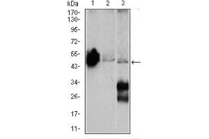 Western blot analysis using ENO2 antibody against Mouse brain (1), NIH3T3 (2), and C6 (3) cell lysate. (ENO2/NSE 抗体  (AA 251-433))