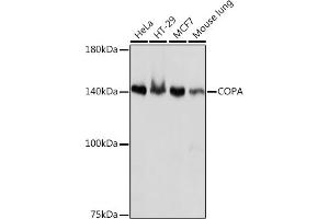 Western blot analysis of extracts of various cell lines, using COPA Rabbit mAb (ABIN7266423) at 1:1000 dilution. (COPA 抗体)
