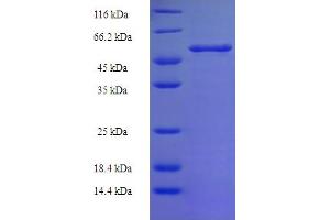 SDS-PAGE (SDS) image for Malic Enzyme Complex, Mitochondrial (Mod2) (AA 1084-1419) protein (His-SUMO Tag) (ABIN5710744)