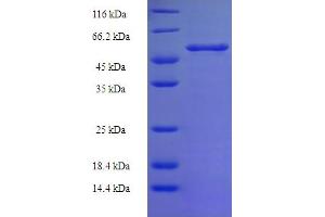 SDS-PAGE (SDS) image for Malic Enzyme Complex, Mitochondrial (Mod2) (AA 1084-1419) protein (His-SUMO Tag) (ABIN5710744) (Malic Enzyme Complex, Mitochondrial (Mod2) (AA 1084-1419) protein (His-SUMO Tag))