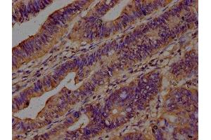 Immunohistochemistry (IHC) image for anti-CAP, Adenylate Cyclase-Associated Protein 1 (CAP1) (AA 22-157) antibody (ABIN7143354)