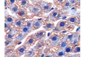 Immunohistochemistry (IHC) image for anti-Ferritin, Heavy Polypeptide 1 (FTH1) (AA 1-182) antibody (ABIN1078027)