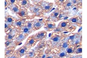 DAB staining on IHC-P; Samples: Rat Liver Tissue (FTH1 抗体  (AA 1-182))