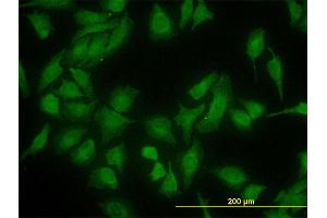 Immunofluorescence of monoclonal antibody to DNAJC10 on HeLa cell.