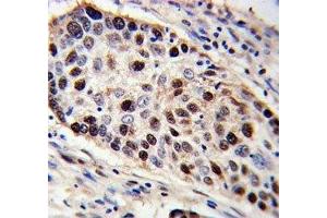 Immunohistochemistry (IHC) image for anti-Proliferating Cell Nuclear Antigen (PCNA) (AA 231-261) antibody (ABIN3032321)