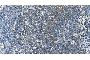 IHC analysis of Carbonic Anhydrase I/CA1 using anti-Carbonic Anhydrase I/CA1 antibody (ABIN7602620). (CA1 抗体  (AA 9-261))