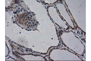 Immunohistochemical staining of paraffin-embedded Human thyroid tissue using anti-EIF4E2 mouse monoclonal antibody. (EIF4E2 抗体)
