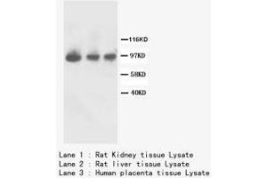 Image no. 2 for anti-Fibroblast Growth Factor Receptor 2 (FGFR2) (C-Term) antibody (ABIN1493068) (FGFR2 抗体  (C-Term))