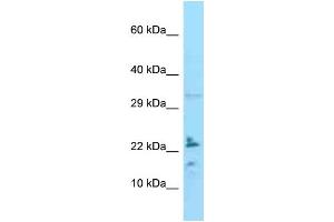 WB Suggested Anti-IL24 Antibody Titration: 1. (IL-24 抗体  (C-Term))