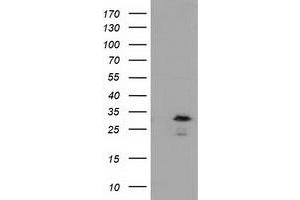Western Blotting (WB) image for anti-RASD Family, Member 2 (RASD2) antibody (ABIN1500695) (RASD2 抗体)