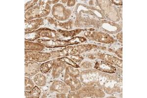 Immunohistochemical staining of human kidney with KLF17 polyclonal antibody  shows strong cytoplasmic positivity in distal tubules at 1:200-1:500 dilution. (KLF17 抗体)