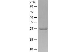 Western Blotting (WB) image for Polybromo 1 (PBRM1) (AA 53-345) protein (His tag) (ABIN7124509) (Polybromo 1 Protein (PBRM1) (AA 53-345) (His tag))