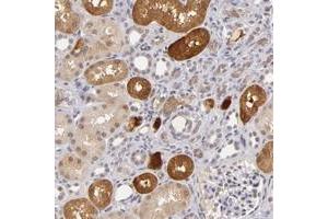 Immunohistochemical staining of human kidney with ZNF205 polyclonal antibody  shows cytoplasmic positivity in cells in tubules at 1:20-1:50 dilution. (ZNF205 抗体)