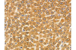 ABIN6258061 and ABIN6274644 at 1/100 staining Rat liver tissue by IHC-P.