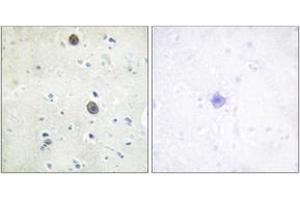 Immunohistochemistry analysis of paraffin-embedded human brain, using Amyloid beta A4 (Phospho-Thr743/668) Antibody. (APP 抗体  (pThr743))