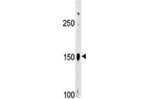Western Blotting (WB) image for anti-C-Abl Oncogene 1, Non-Receptor tyrosine Kinase (ABL1) (pTyr412) antibody (ABIN3001744) (ABL1 抗体  (pTyr412))