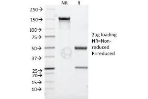 SDS-PAGE Analysis Purified CD30 Monoclonal Antibody (Ki-1/779). (TNFRSF8 抗体)