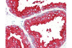 Anti-ELMO3 antibody IHC staining of human prostate. (ELMO3 抗体  (AA 760-773))