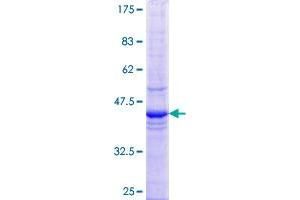 ETF1 Protein (AA 338-437) (GST tag)