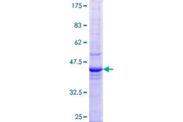 ETF1 Protein (AA 338-437) (GST tag)