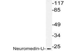 Western blot (WB) analysis of Neuromedin-U in extracts from HepG2 cells with AP21204PU-N. (Neuromedin U 抗体)
