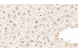 Detection of C8b in Mouse Liver Tissue using Polyclonal Antibody to Complement Component 8b (C8b) (C8B 抗体  (AA 161-503))