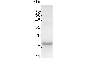SDS-PAGE (SDS) image for Interleukin 10 (IL10) (Active) protein (His tag) (ABIN7884438)
