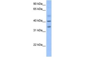 Western Blotting (WB) image for anti-Zinc Finger CCCH-Type Containing 14 (ZC3H14) antibody (ABIN2463623) (ZC3H14 抗体)