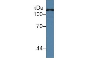 Western Blot; Sample: Human Hela cell lysate; Primary Ab: 2µg/ml Mouse Anti-Human TLR5 Antibody Second Ab: 0. (TLR5 抗体  (AA 693-858))