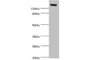 Western blot All lanes: SPAG5 antibody at 2 μg/mL Secondary Goat polyclonal to rabbit IgG at 1/10000 dilution Predicted band size: 134 kDa Observed band size: 134 kDa (SPAG5 抗体  (AA 1-300))