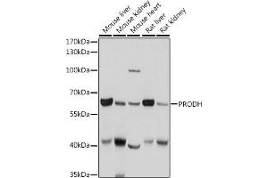 Western blot analysis of extracts of various cell lines, using PRODH antibody (ABIN6128506, ABIN6146242, ABIN6146243 and ABIN6221531) at 1:1000 dilution. (PRODH 抗体  (AA 321-600))