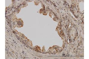 Immunoperoxidase of monoclonal antibody to PAK1 on formalin-fixed paraffin-embedded human prostate. (PAK1 抗体  (AA 191-280))
