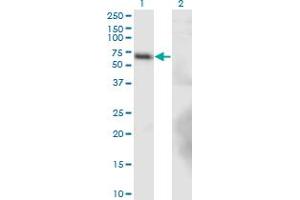 Western Blot analysis of BTBD9 expression in transfected 293T cell line by BTBD9 monoclonal antibody (M02), clone 1G3. (BTBD9 抗体  (AA 2-70))