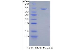 SDS-PAGE of Protein Standard from the Kit (Highly purified E. (Amphiregulin ELISA 试剂盒)