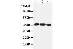Anti-CCR4 antibody, Western blotting All lanes: Anti CCR4  at 0. (CCR4 抗体  (Middle Region))